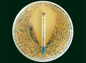 抗结核分枝杆菌药物敏感性检测试纸-MIC